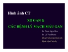 Hình ảnh CT Xơ gan và Các bệnh lý mạch máu gan