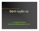 Bệnh tuyến vú