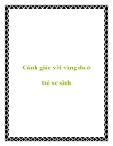 Cảnh giác với vàng da ở trẻ sơ sinh