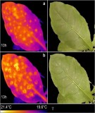 Hình thái giải phẫu thực vật: Rễ cây - Bài giảng ĐH Y Dược Huế