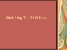 Bài giảng Bệnh ung thư nhũ hoa