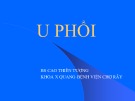 Bài giảng U phổi - BS. Cao Thiên Tượng