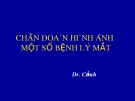 Bài giảng Chẩn đoán hình ảnh một số bệnh lý mắt - Dr. Cảnh