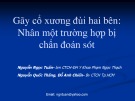 Bài giảng Gãy cổ xương đùi hai bên: Kinh nghiệm chẩn đoán sót từ BS. Nguyễn Ngọc Tuấn