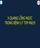 Bài giảng X-quang lồng ngực trong bệnh lý tim mạch