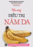 Cẩm nang điều trị nám da hiệu quả nhất