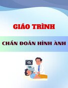 Giáo trình Chẩn đoán hình ảnh [chuẩn nhất]